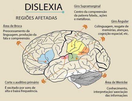 dislexia